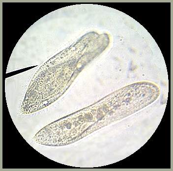 The upper image shows two Paramecia reproducing by conjugation.